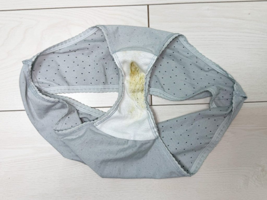 モ貫通！？茶色染み！？２５歳るいちゃんの激臭パンツを４連紹介！【下着紹介】 - 画像4
